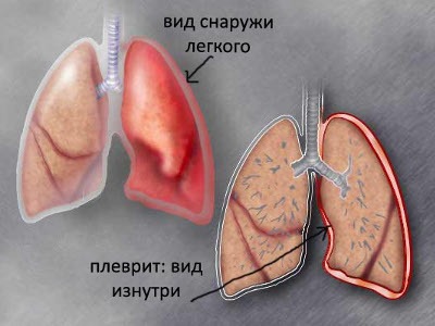 что болит в правом боку и отдает в спину
