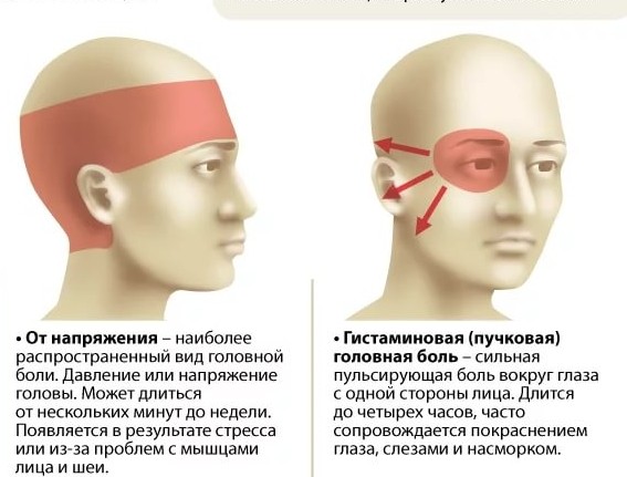 болит нерв в голове с левой стороны