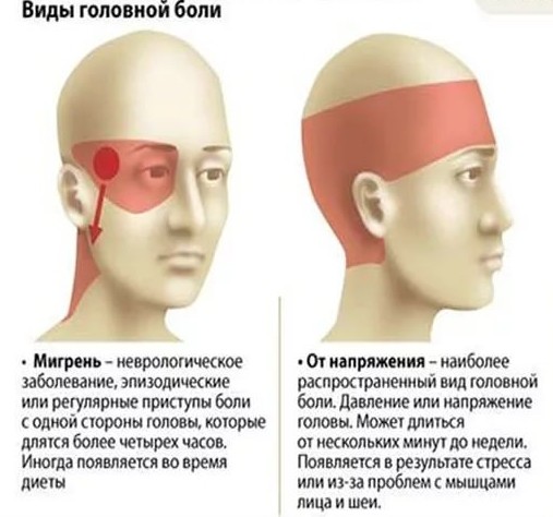 Болит нерв на голове справа
