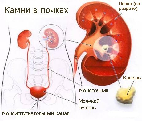 Не могу сесть болит спина