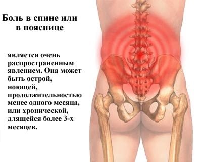 Где может болит спина