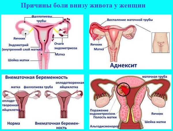 За сколько до месячных начинает болеть живот и спина