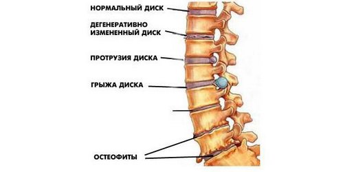 Что делать если болит пресс ноги и спина