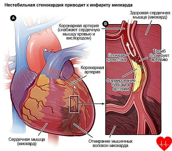 Болит спина справа как лечить