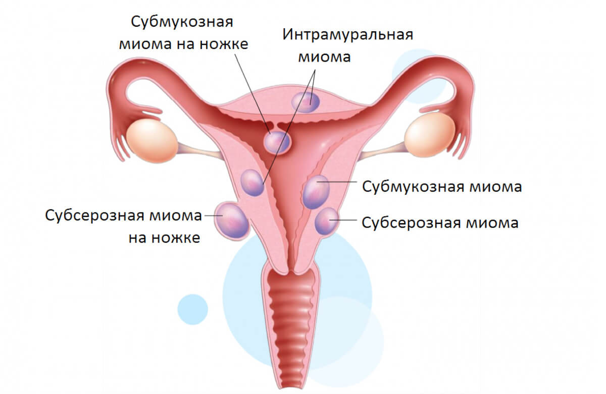 За сколько до месячных начинает болеть живот и спина