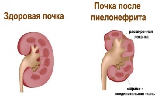 почему после высокой температуры болит спина