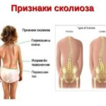 болят ноги и спина после бега