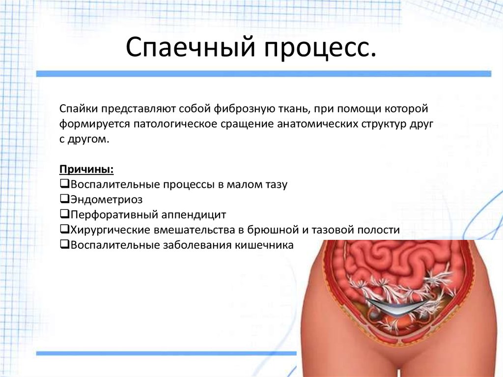 За сколько до месячных начинает болеть живот и спина