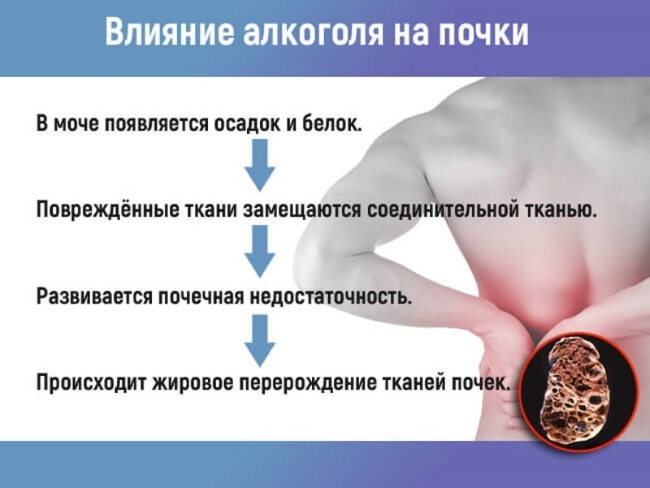 Влияние алкоголя на почки Влияние алкоголя на почки